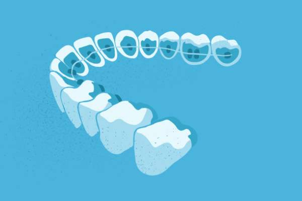 惟德口腔醫(yī)院口腔正畸好不好？